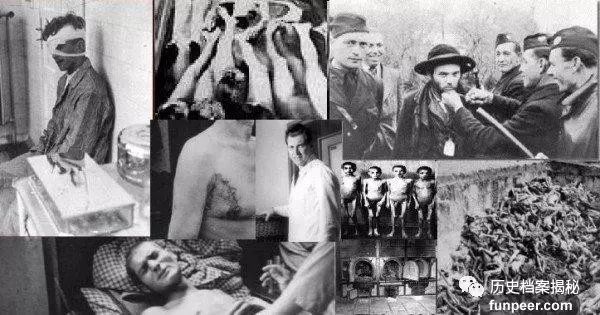 揭秘：二战德国惨绝人寰的“纳粹人体实验”